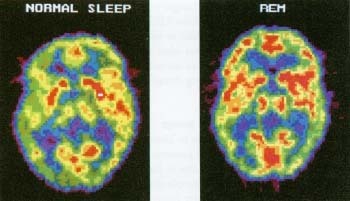 Brain Function During REM Sleep - MyEssayDoc